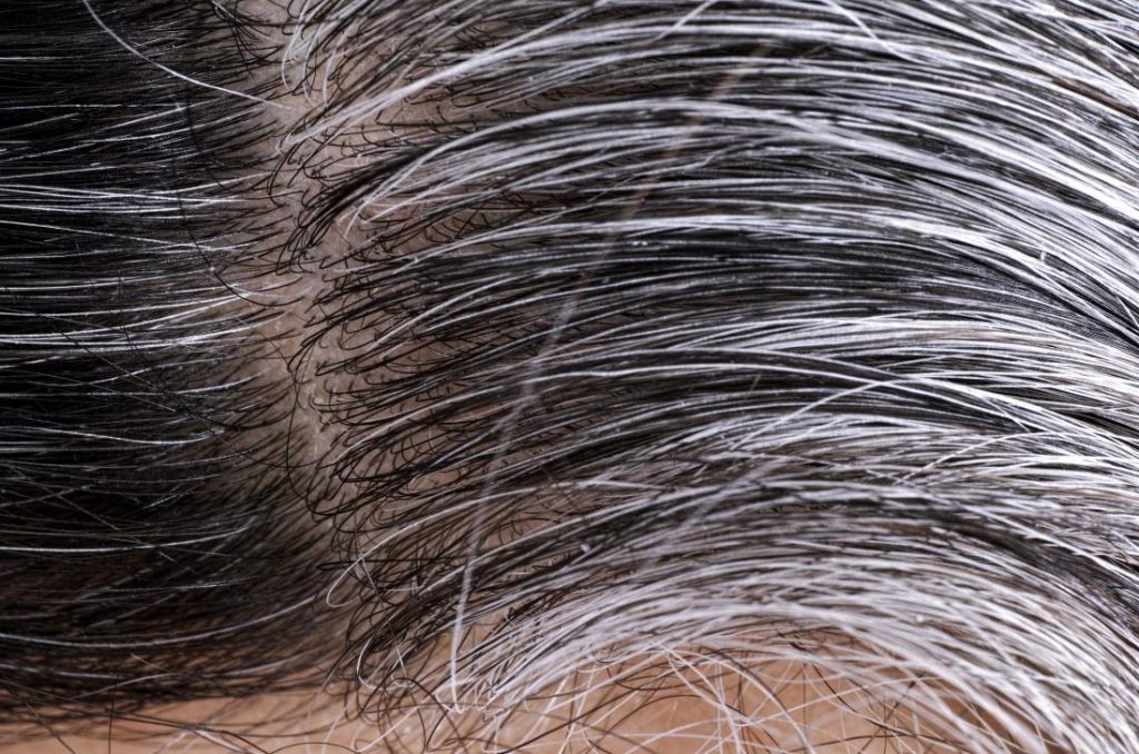 जानिए सफेद बालों के कारण और प्राकृतिक रूप से इसे रोकने के आसान उपाय I Know the causes of white hair and easy ways to prevent it naturally